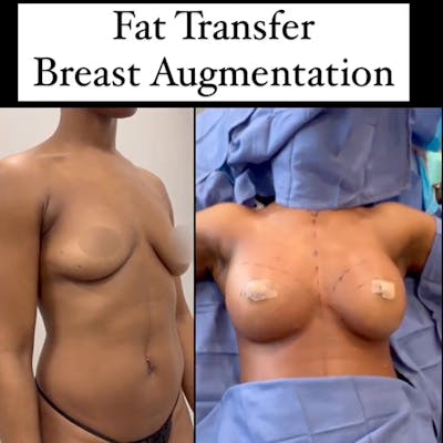 Reels Gallery Before & After Gallery - Patient 216490 - Image 1