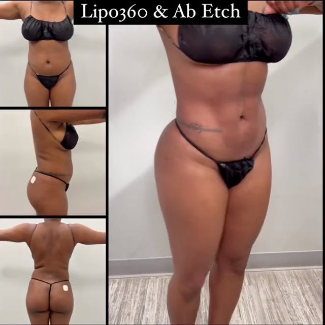 Reels Gallery - Archive of instagram images etc Before & After Gallery - Patient 200159 - Image 1