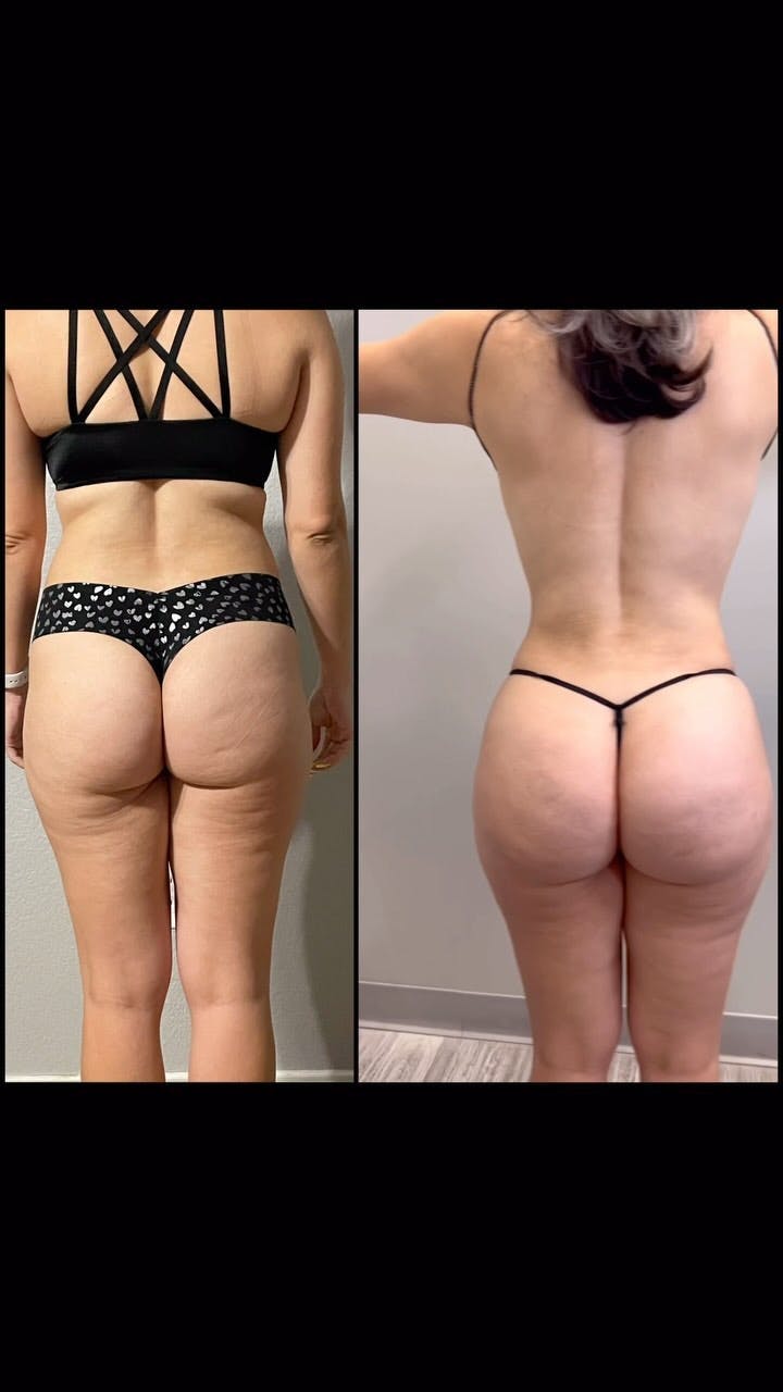 Reels Gallery - Archive of instagram images etc Before & After Gallery - Patient 287723 - Image 1