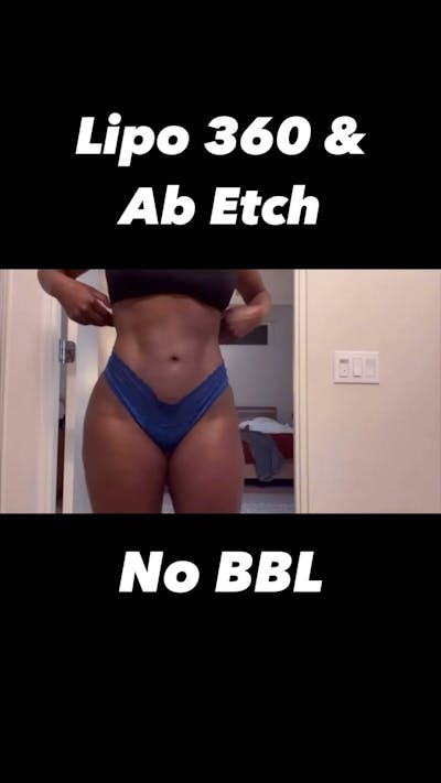 Reels Gallery Before & After Gallery - Patient 899728 - Image 1