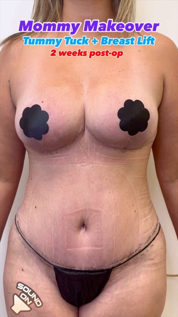 Reels Gallery - Archive of instagram images etc Before & After Gallery - Patient 416582 - Image 1