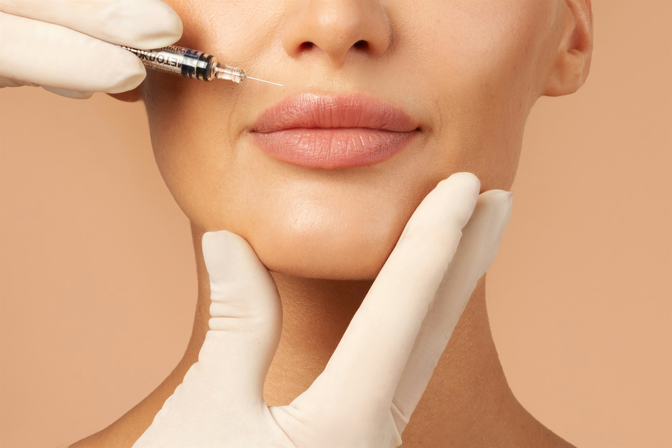 woman getting lip filler