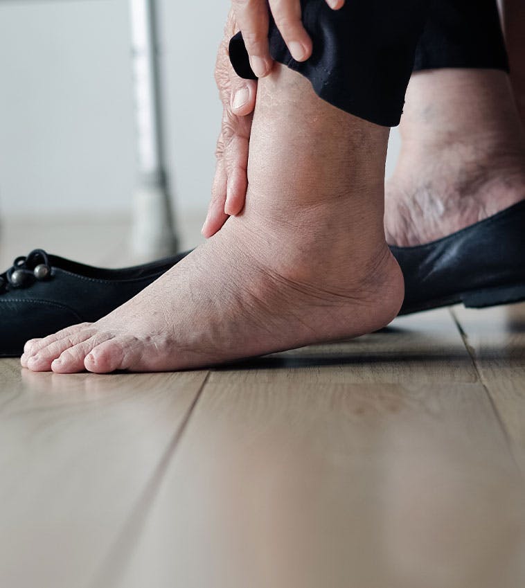 A person rubbing their foot suffering from diabetes, needing diabetic ulcer treatment in San Francisco.