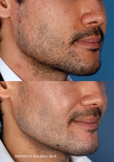 Skin Care Before & After Gallery - Patient 49268461 - Image 1