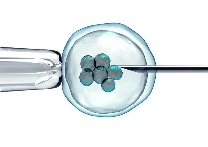 IVF procedure