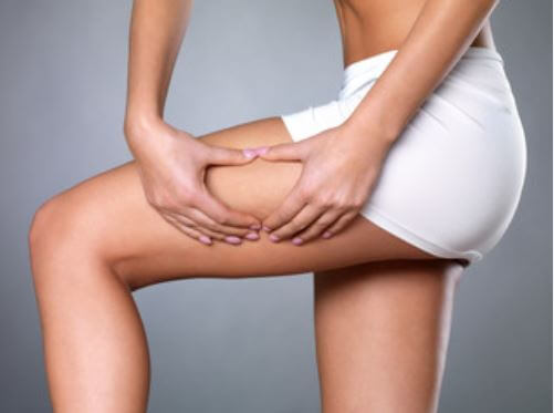 How Much Does Cellulite Reduction Cost in Rancho Santa Margarita