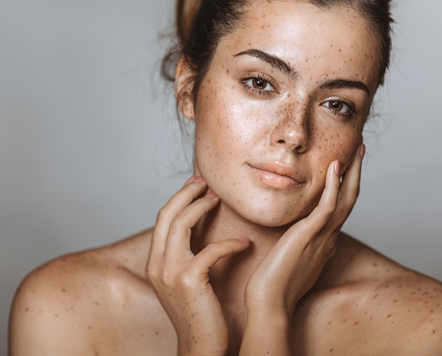 Uneven Skin Tone Pure Beauty Skin Care & Medical Spa