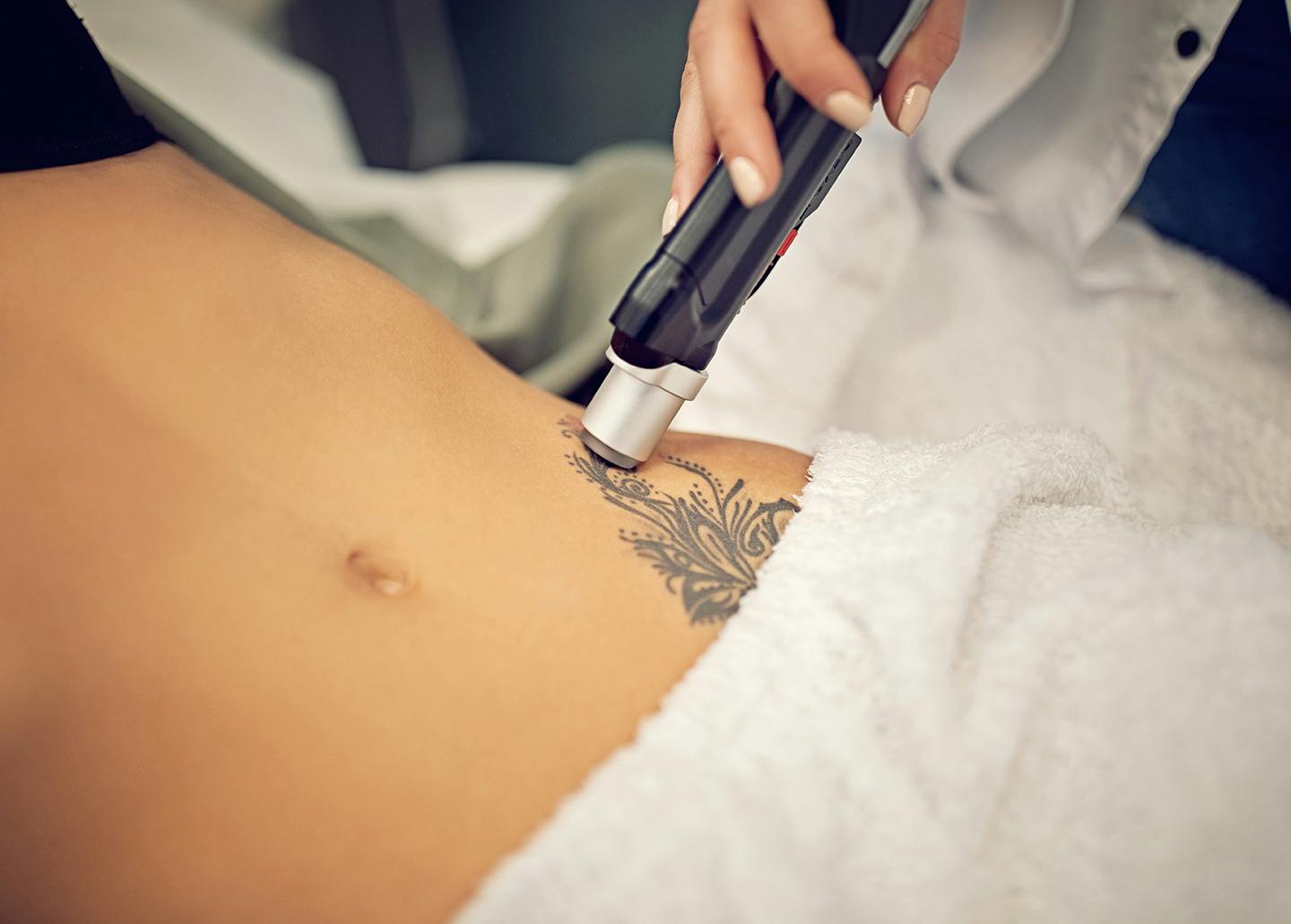 Laser Tattoo Removal Friendswood | Laser Tattoo Removal in League City TX Laser Tattoo Removal Friendswood | Laser Tattoo Removal in League City TX