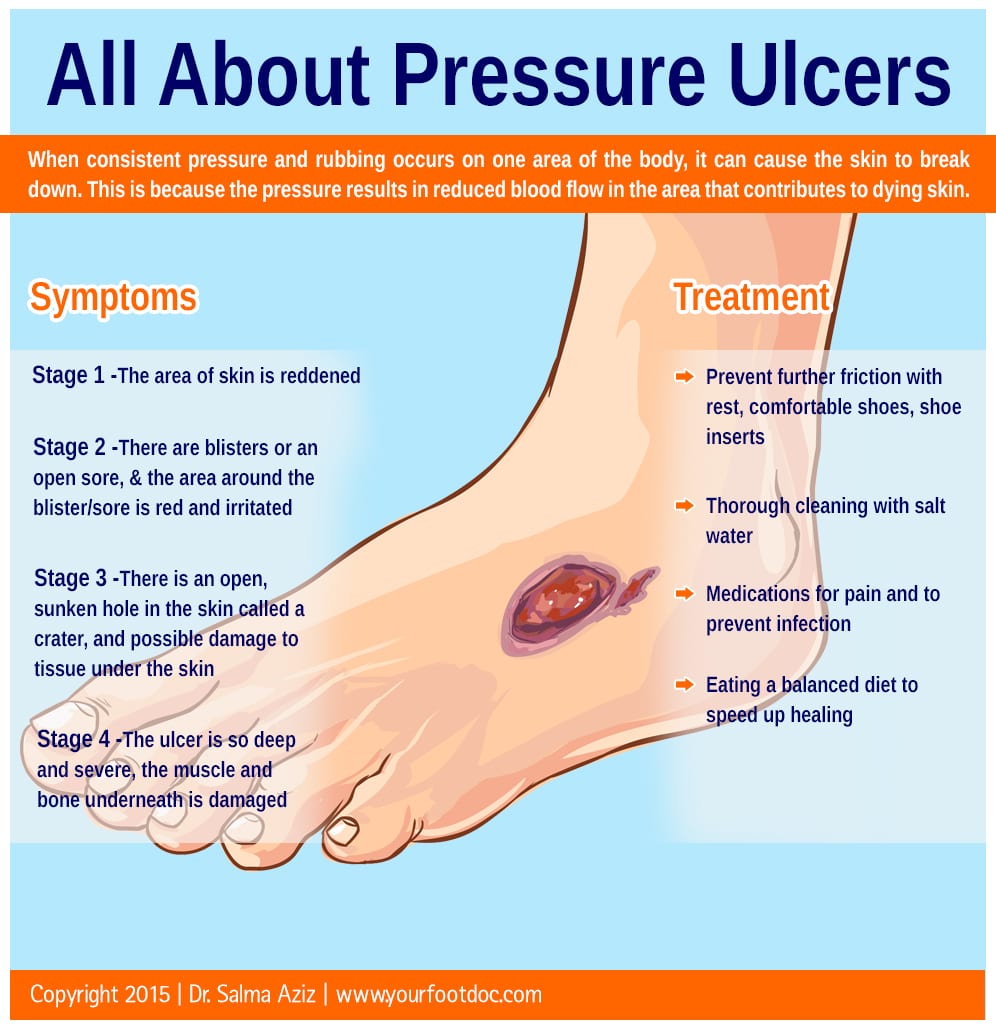 Pressure Ulcer Stage 1 Foot