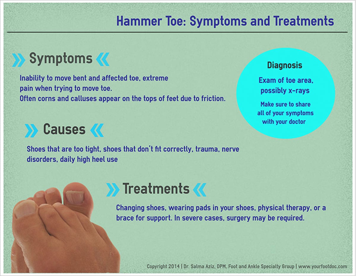 Hammer Toe Infographic
