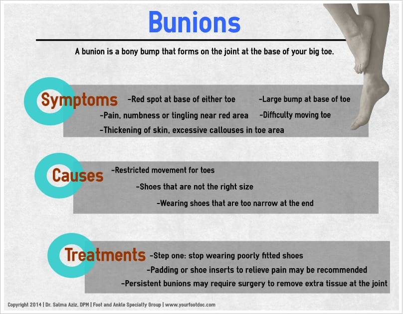 Bunions Infographic