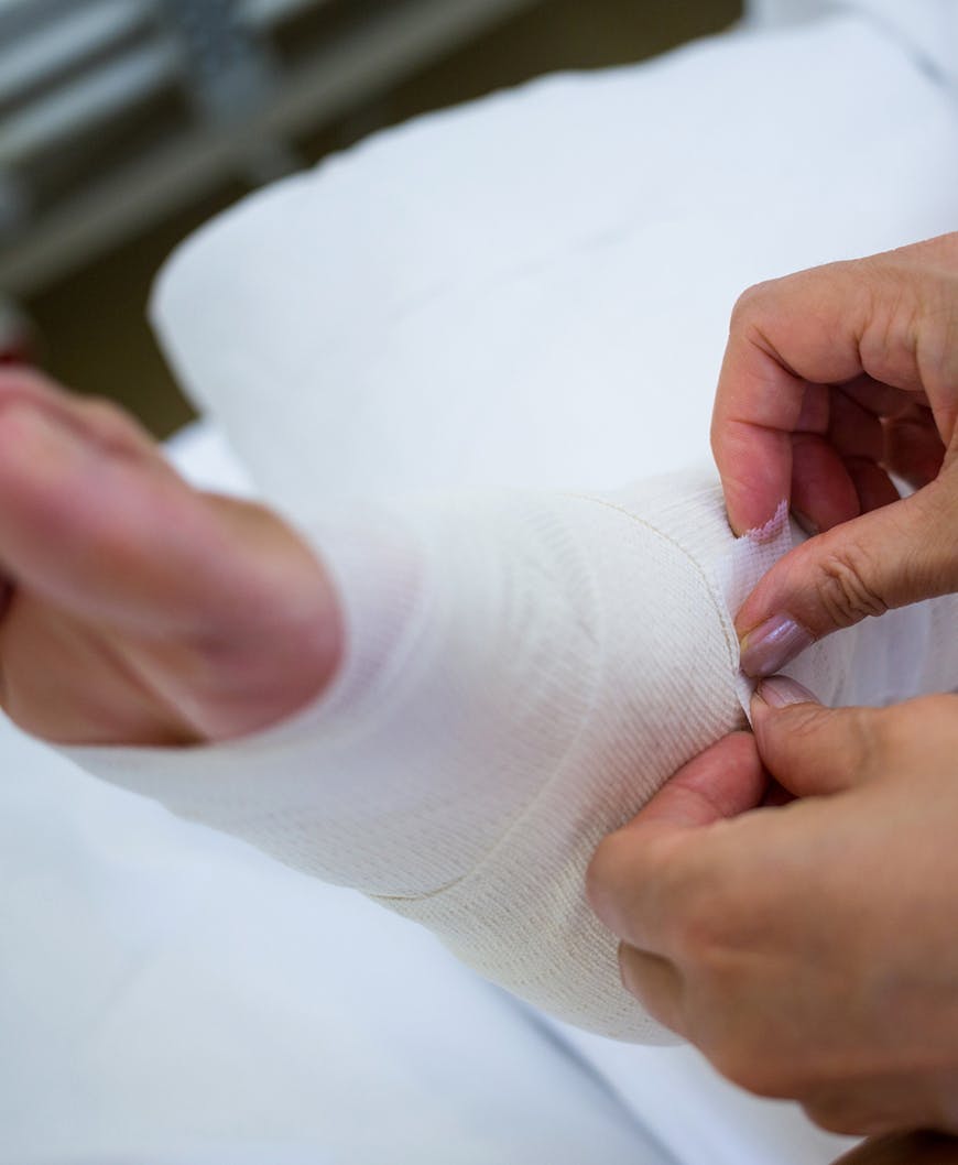 Patient Being Bandaged After Foot Fracture In Newport Beach.