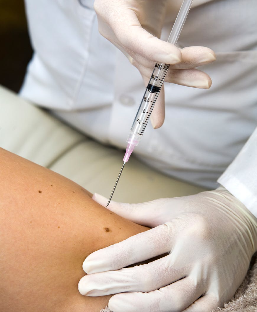 Doctor Administering Prp Foot Therapy In Newport Beach.