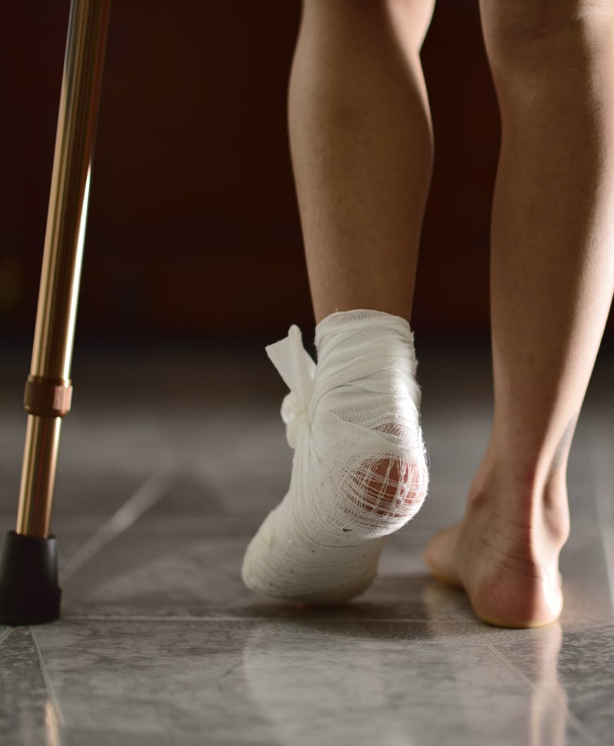 Women's Foot with Bandage Over Her Ankle.