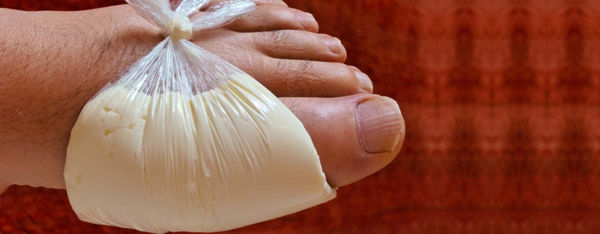 gout symptoms and treatments orange county foot and ankle doctor