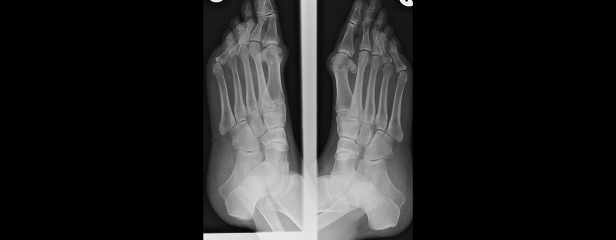 an xray of the top of a pair of feet