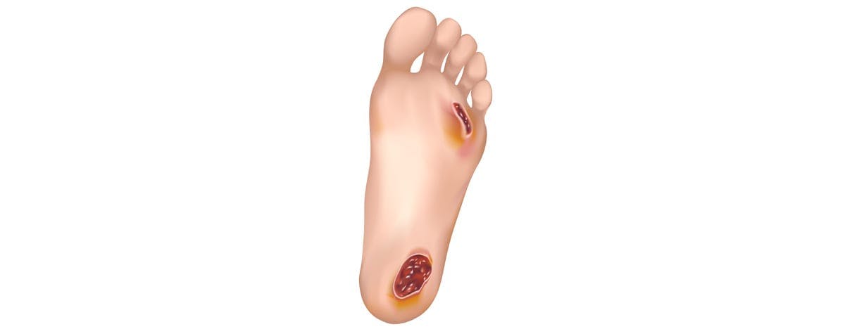 a close up of an animation of the bottom of a foot with wounds