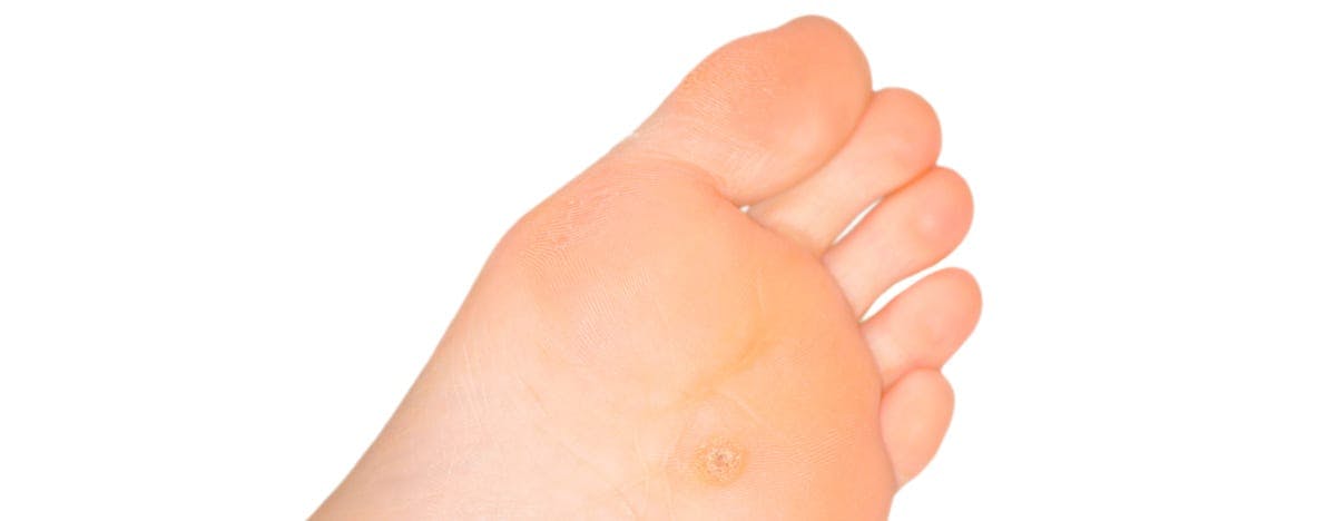 a close up of the bottom of a foot