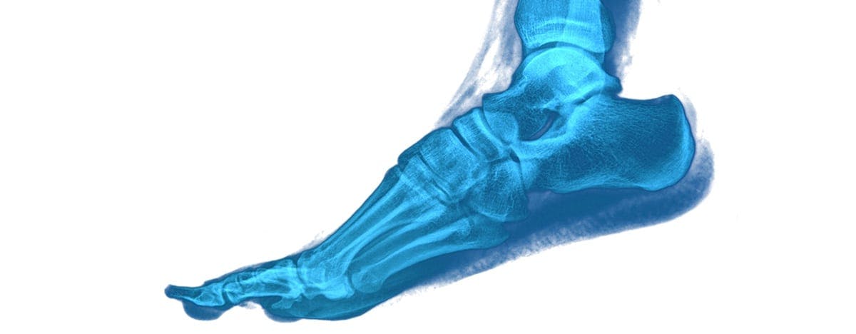 a blue animated image of the bones of a foot