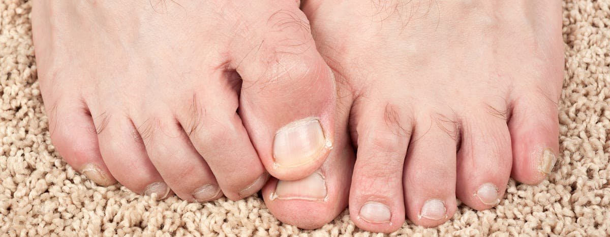 a close up of male feet on carpet