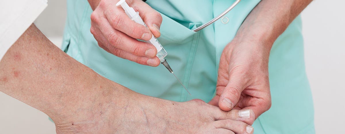 and image of a doctor about to inject a bunion on a foot