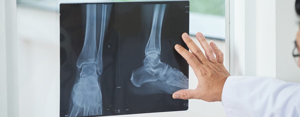 an image of a doctor looking at foot xrays