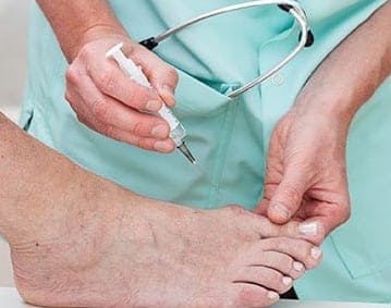 Bunion Removal Surgery