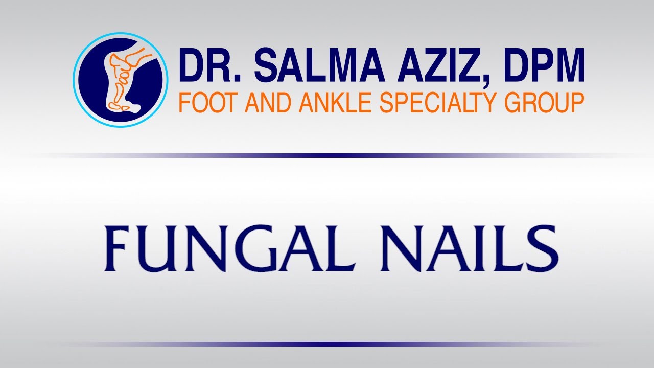 Dr. Aziz Foot and Ankle Speciality Group Inc. Fungal Nails