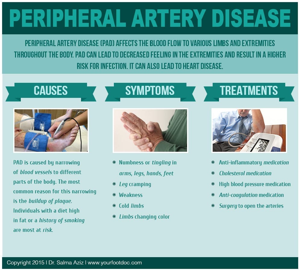 peripheral artery disease infographic