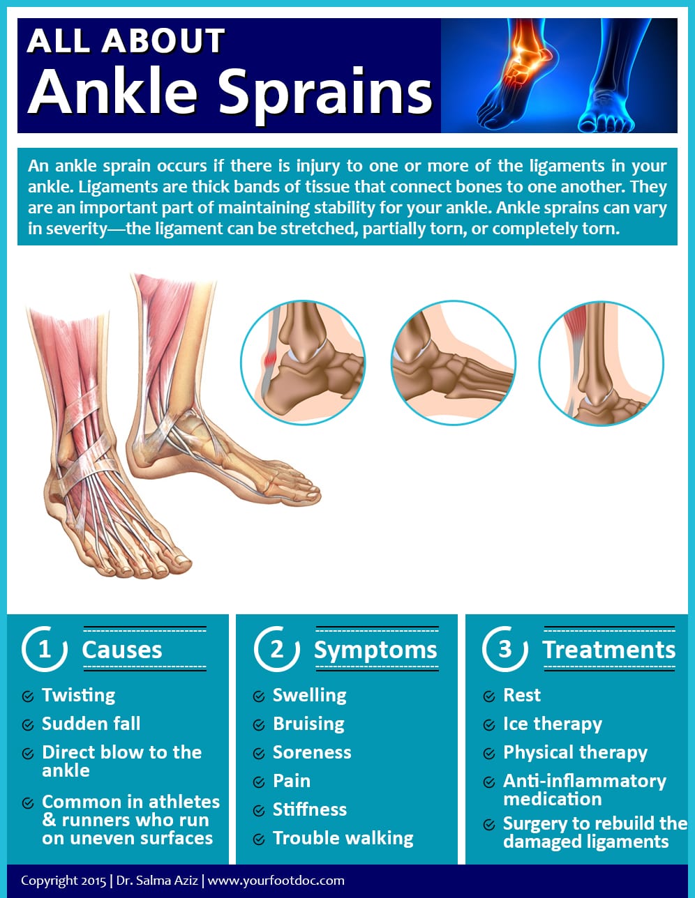 Ankle Sprains Infographic