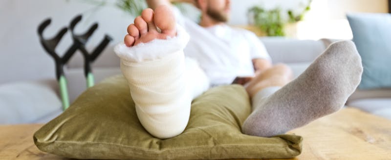 Man with cast after ankle replacement surgery