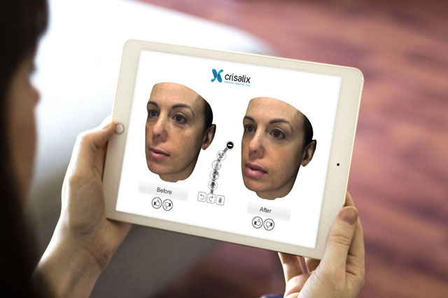Crisalix Virtual Aesthetics system demo