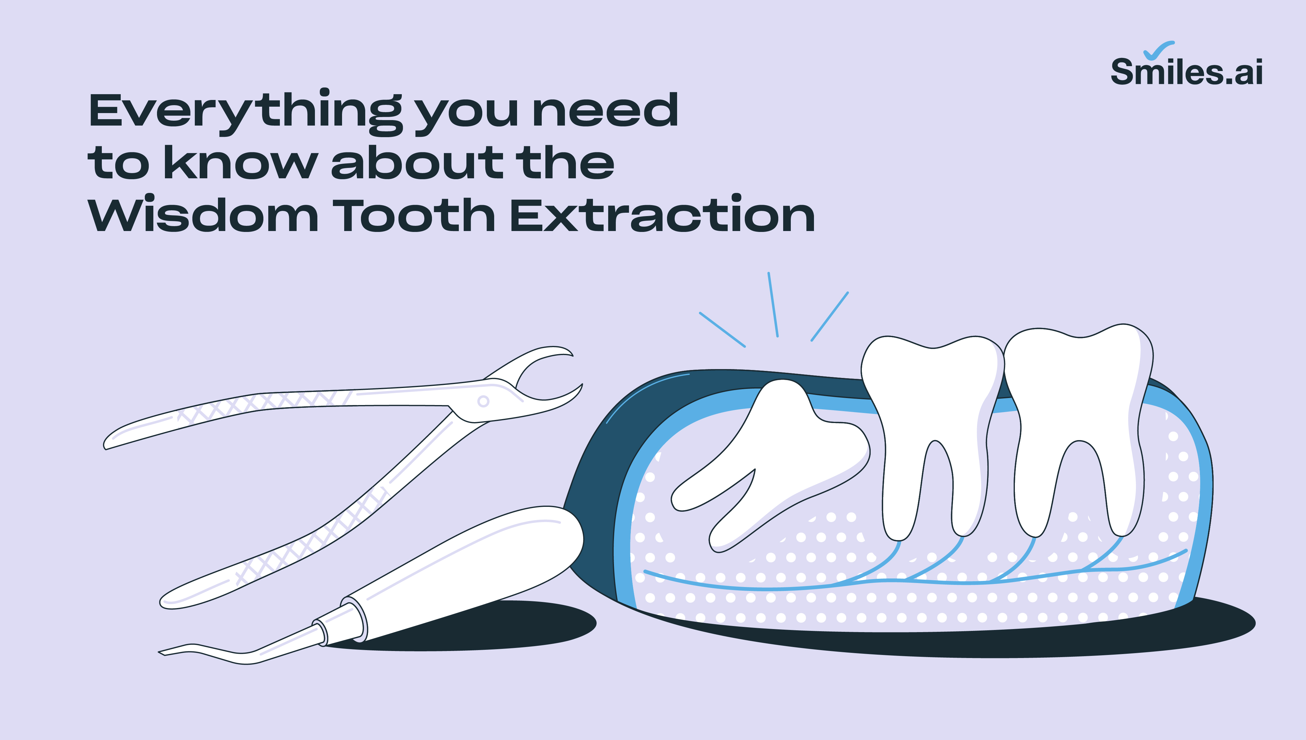 Wisdom tooth extraction