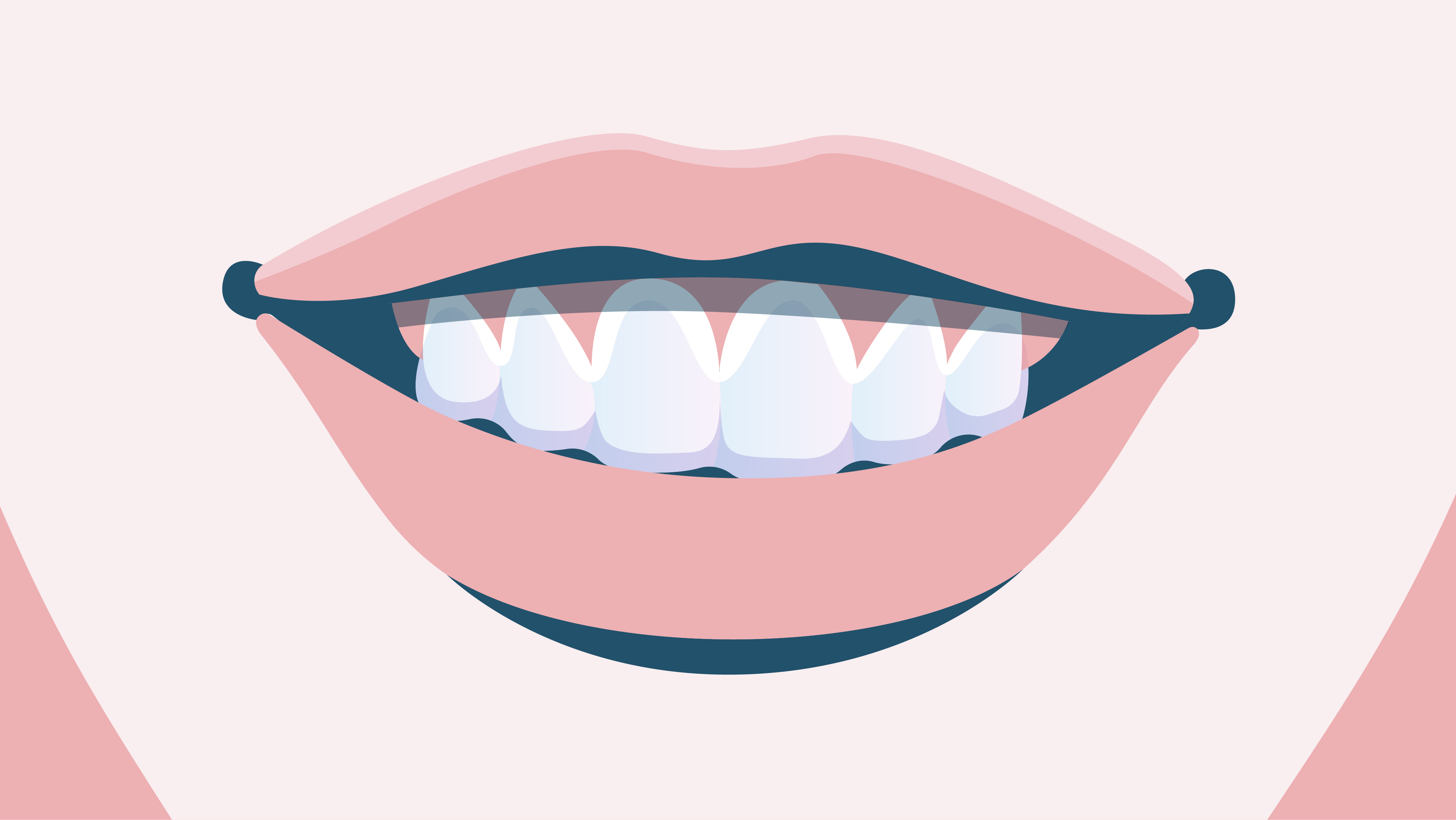 Clear Aligners vs. Braces: Understanding the Differences - Kanata South  Dental