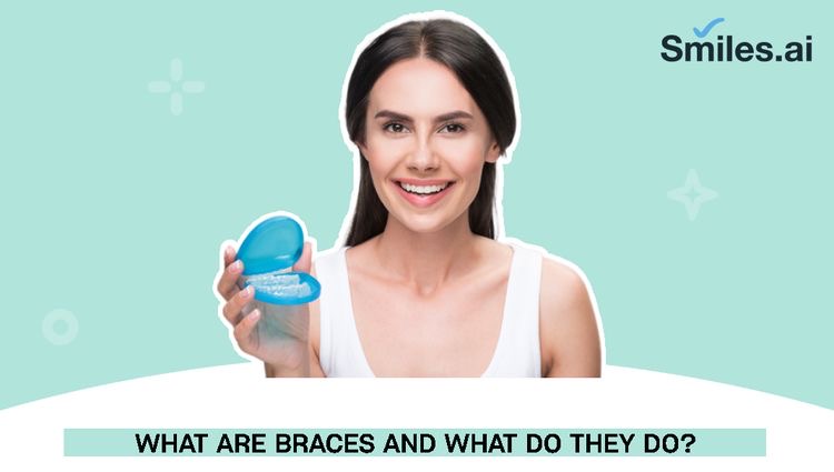 What are Braces and what do they do?