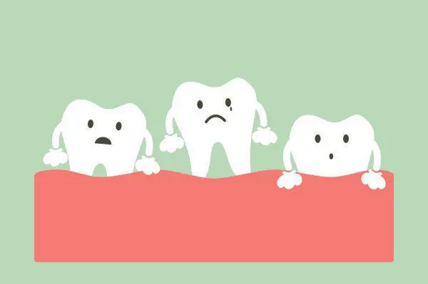 tooth mobility