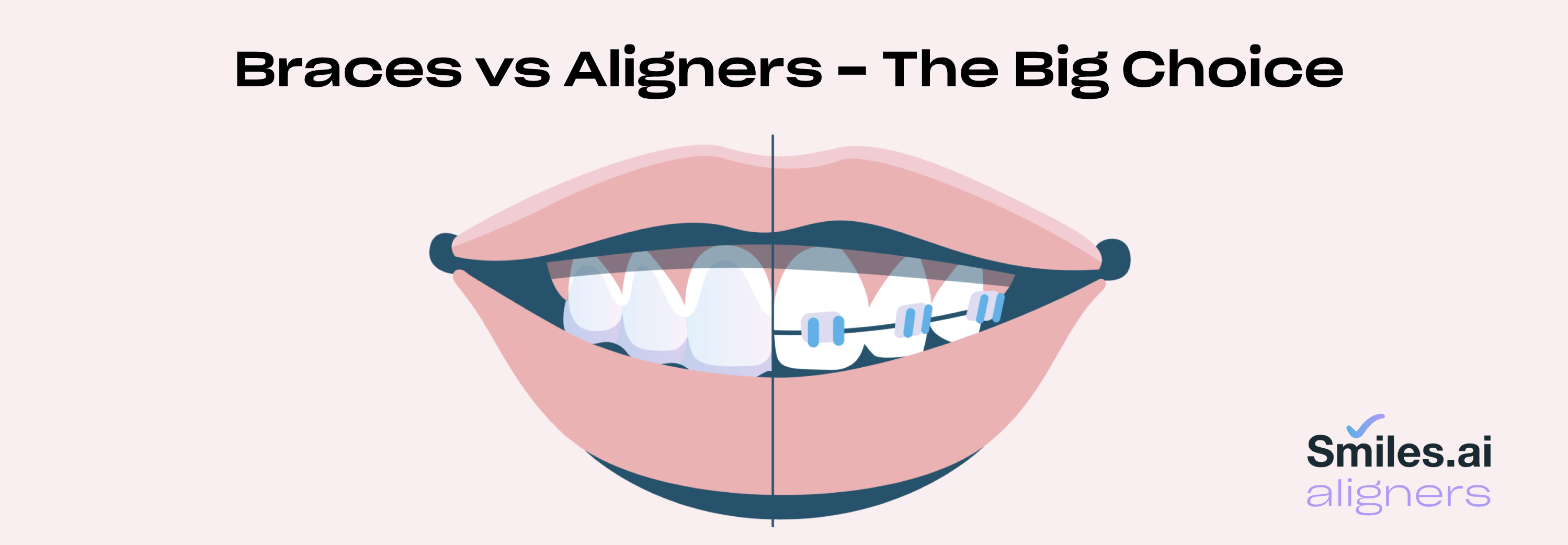 Braces vs Aligners - The Big Choice