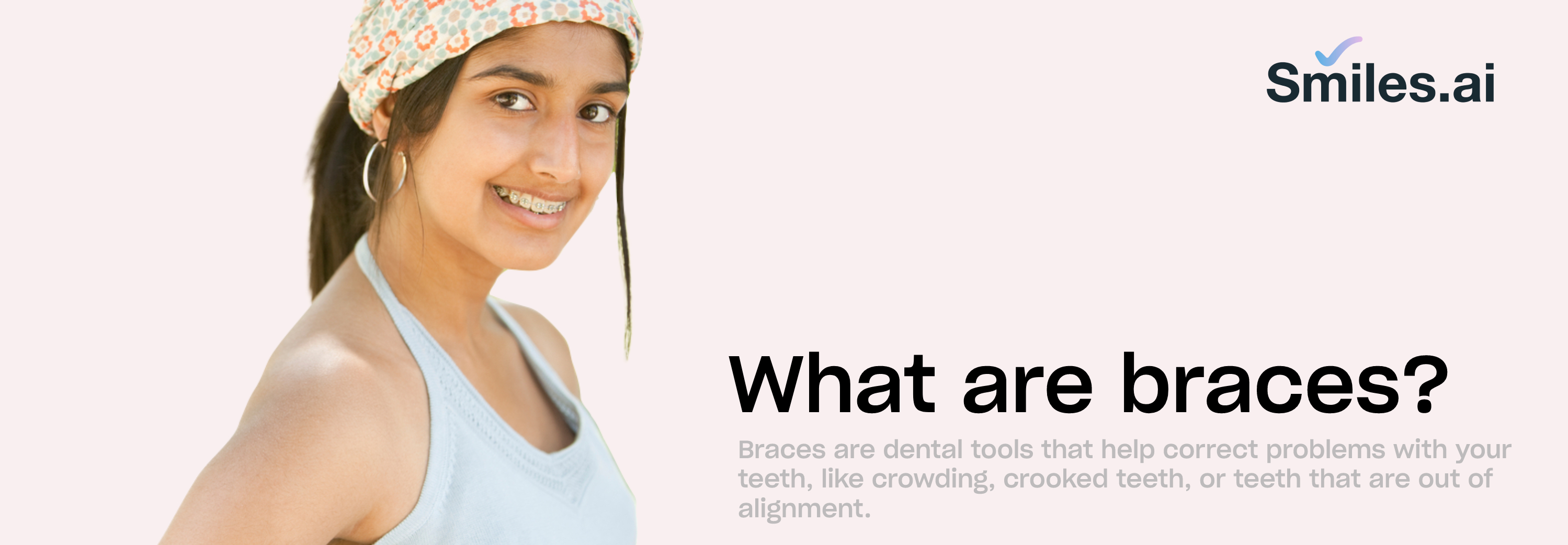 What are braces? Smiles.ai