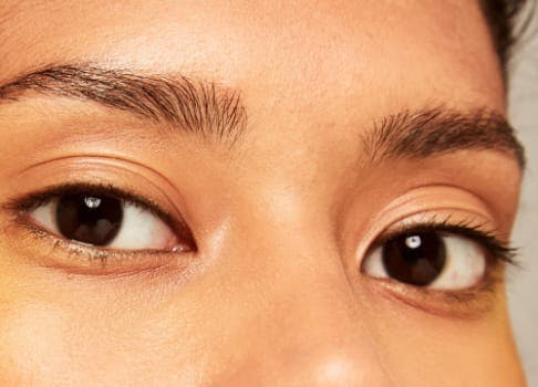 4 Reasons Younger Patients Are Getting Eyelid Surgery RealSelf News