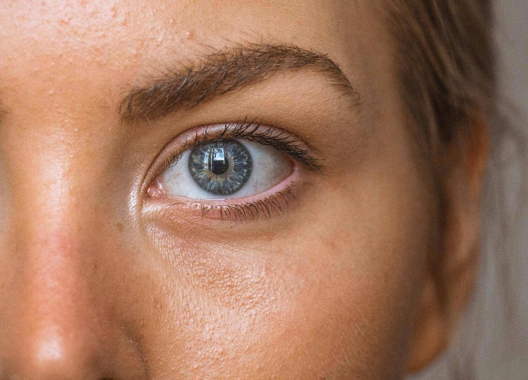 The 3 Best Under-Eye Filler Alternatives