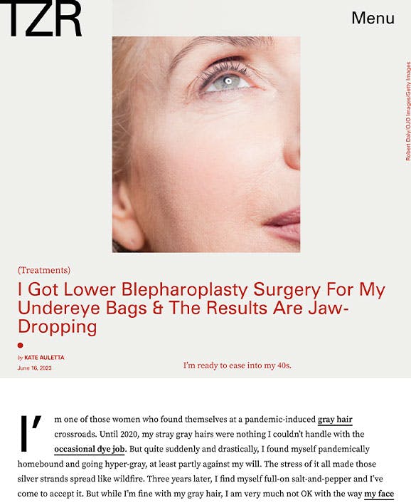 I Got Lower Blepharoplasty Surgery For My Undereye Bags & The Results Are Jaw-Dropping