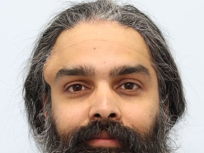 Reconstructive Before & After Gallery - Patient 387503 - Image 1