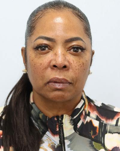Microneedling Before & After Gallery - Patient 128192 - Image 2