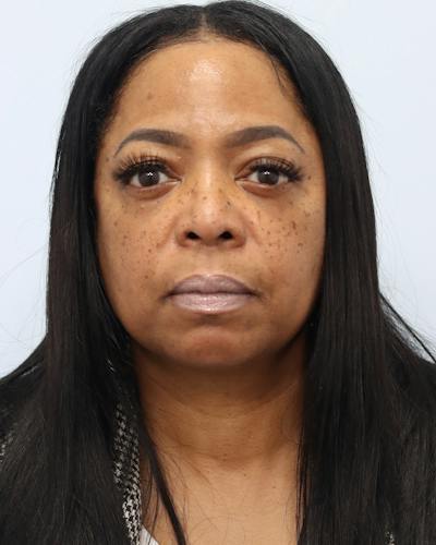 Microneedling Before & After Gallery - Patient 128192 - Image 1