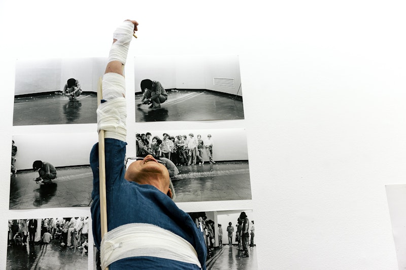 A man in a denim shirt with glasses looks upwards as he points upwards with his right arm, which wrapped in bandages and aligned straight with a splint. Behind him are black and white printed photos of a man crouching in front of a crowd.