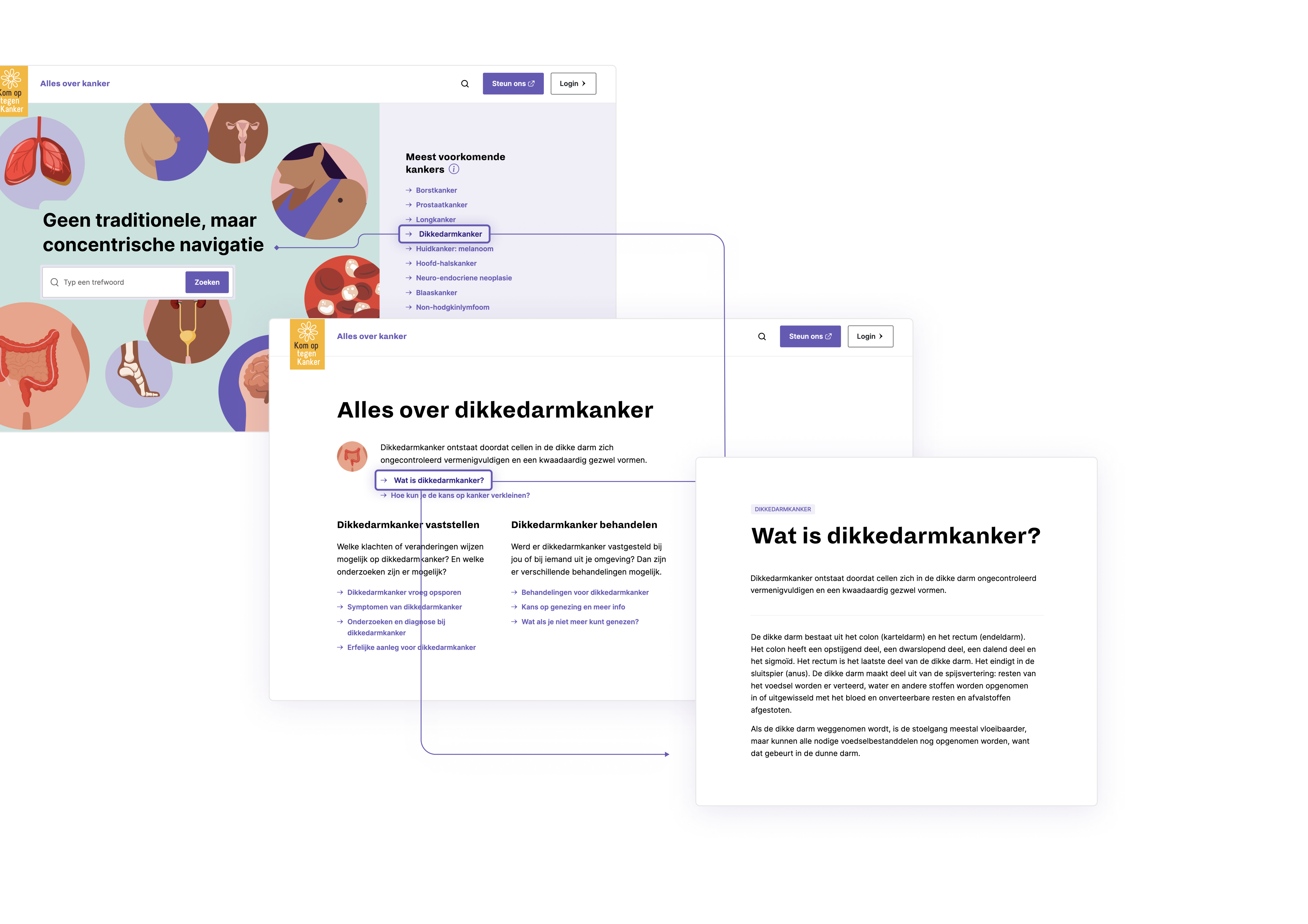 3 websites screens of the new allesoverkanker.be website that show how forward navigation works. Forward navigation guides the user in an intuitive flow through a website.