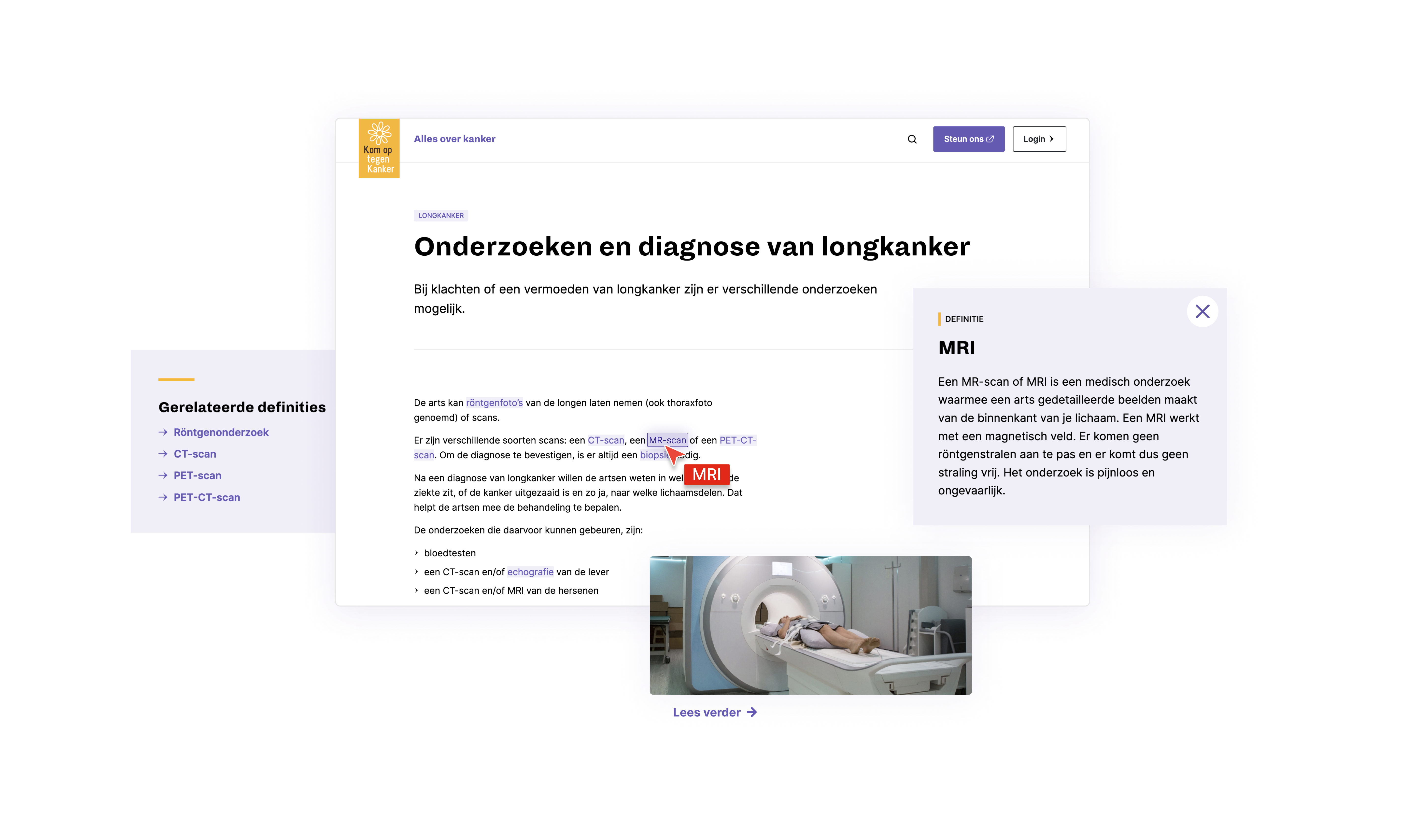Website screens showing how we integrated the definitions of technical jargon on the web pages itself. This way we avoid for people to navigate to another page to look up the definition of medical terms.