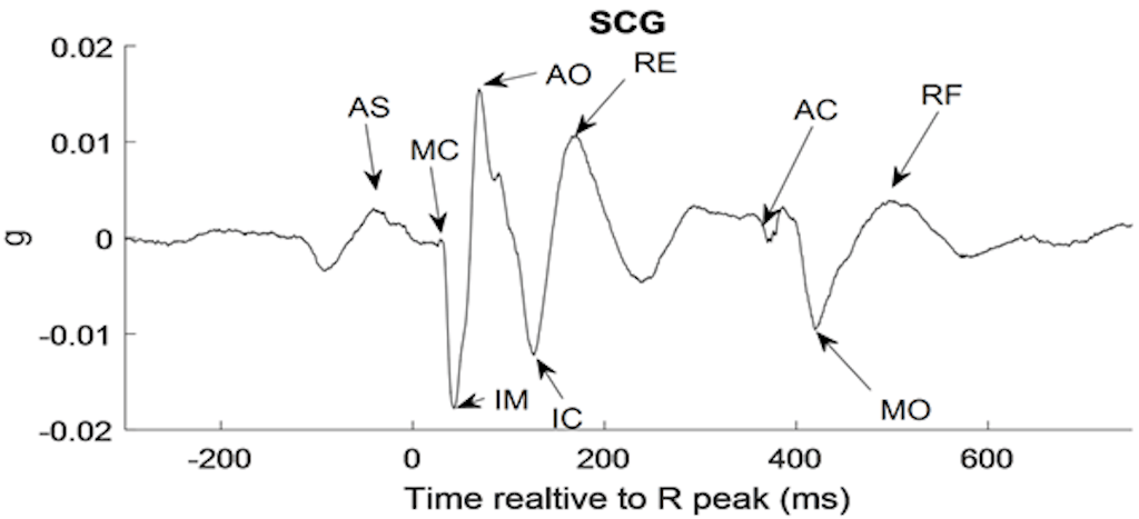 Visualization of a normal SCG heartbeat from a healthy subject