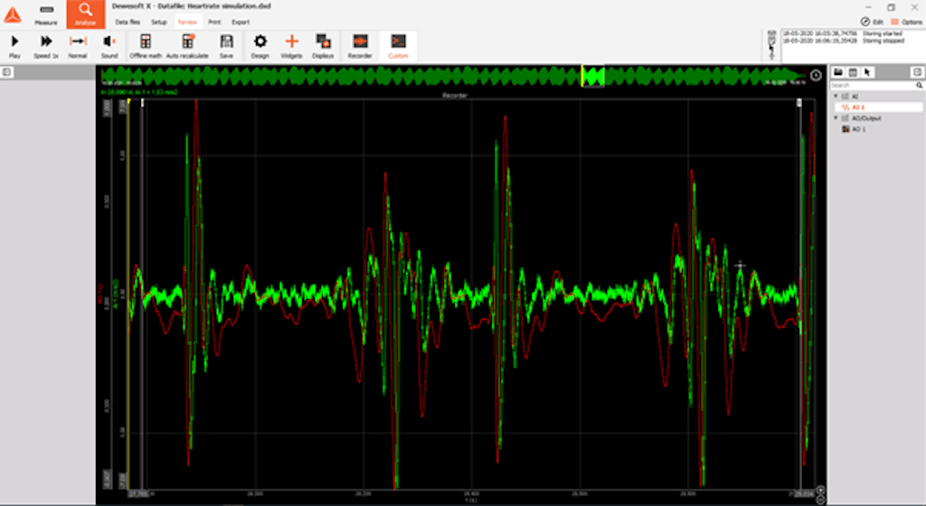 Reference accelerometer in the recorder view