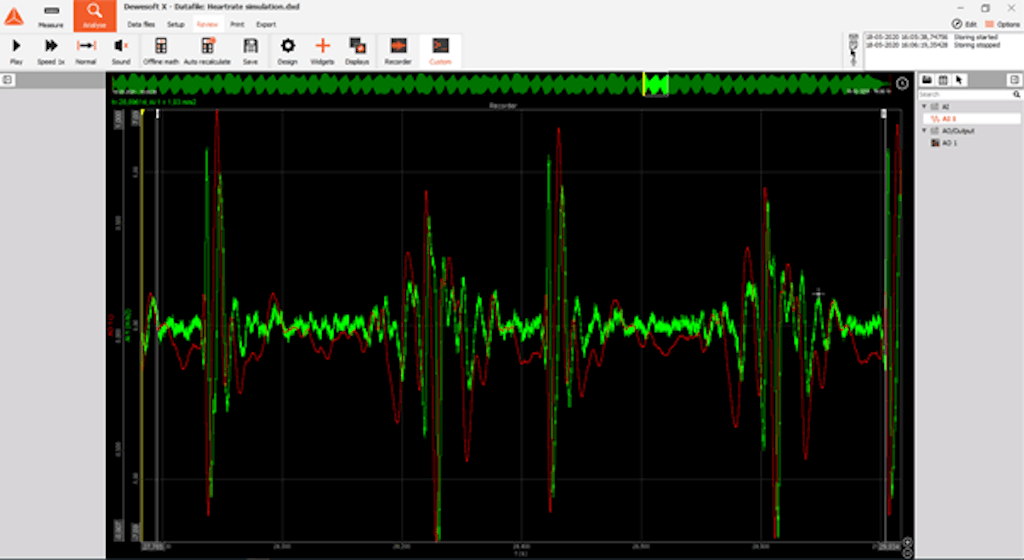 Accelerometro di riferimento nella vista registratore